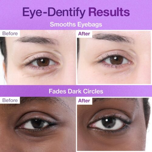 پچ زیر چشم NAD+ کلاژن شماره ۹ نامبوزین